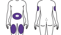 Choose your injection site